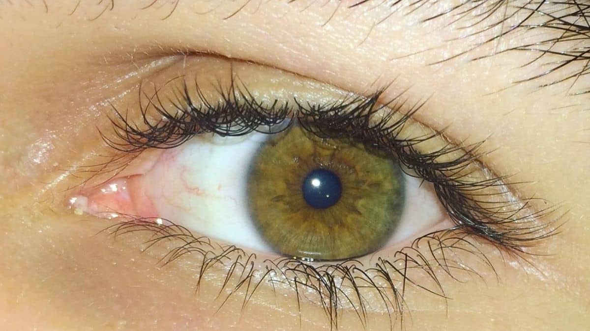 facts about hazel eyes with the cause of hazel eyes